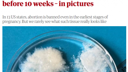 Abort - bare en tot vat?