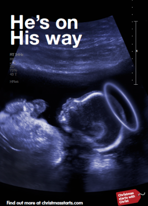 baby scan Jesus